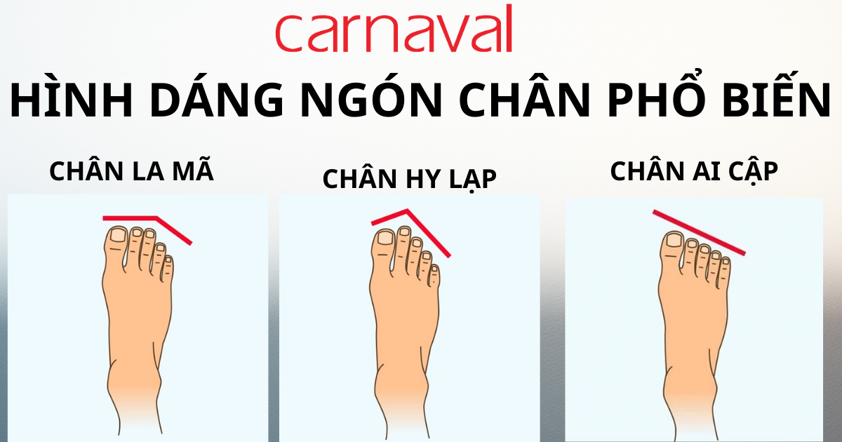các hình dáng ngón chân phổ biến